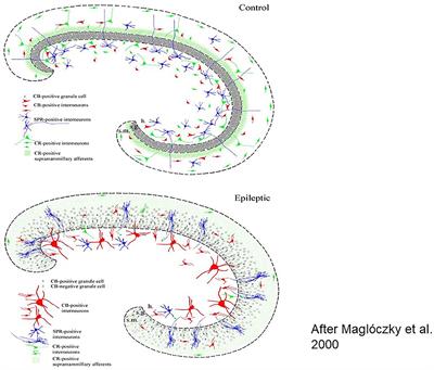 Sleep and Epilepsy Link by Plasticity